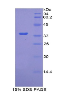 Recombinant Coagulation Factor V (F5)