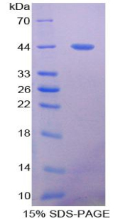 Recombinant Mucin 5 Subtype B (MUC5B)