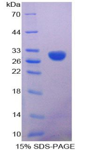 Recombinant Calretinin (CR)