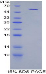 Recombinant TGF Beta Inducible Early Response Gene 1 (TIEG1)