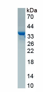 Recombinant TGF Beta Inducible Early Response Gene 1 (TIEG1)