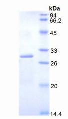 Recombinant Dihydrolipoyl Transacetylase (DLAT)