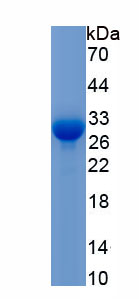 Recombinant Cyclooxygenase-2 (COX 2)