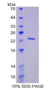 Recombinant Membrane Protein, Palmitoylated 6 (MPP6)