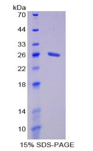 Recombinant Membrane Protein, Palmitoylated 6 (MPP6)