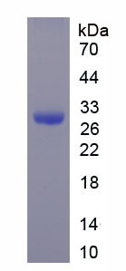 Recombinant Thioredoxin Reductase 1 (TXNRD1)