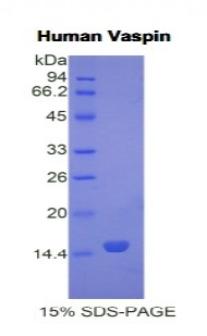 Recombinant Visceral Adipose Tissue Derived Serine Protease Inhibitor (Vaspin)