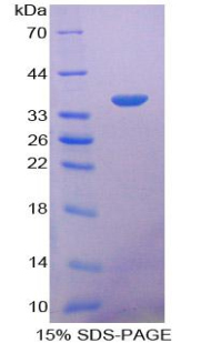 Recombinant Prothrombin Fragment 1+2 (F1+2)