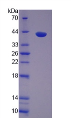 Recombinant Prothrombin Fragment 1+2 (F1+2)