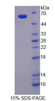 Recombinant Glucose-6-phosphate Dehydrogenase (G6PD)