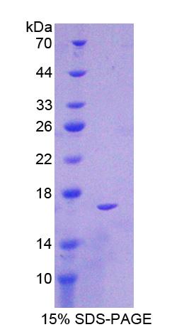 Recombinant Glucose-6-phosphate Dehydrogenase (G6PD)