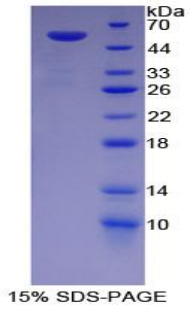 Recombinant Glucose-6-phosphate Dehydrogenase (G6PD)