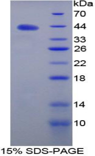 Recombinant C-Type Natriuretic Peptide (CNP)