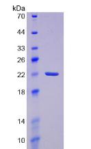 Recombinant Prostaglandin-H2 D-isomerase (PTGDS)