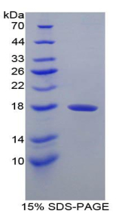 Recombinant Prealbumin (PALB)