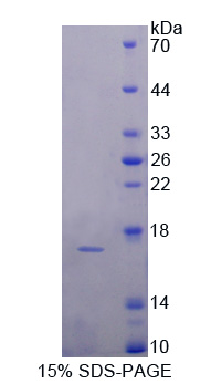 Recombinant Complement Component 7 (C7)