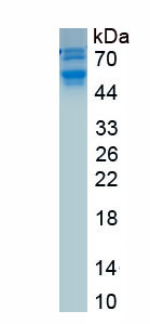 Recombinant Protein C (PROC)