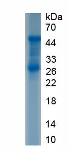 Recombinant Protein C (PROC)