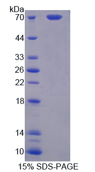 Recombinant Protein Z (PROZ)