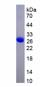 Recombinant Cyclin Dependent Kinase 5 (CDK5)