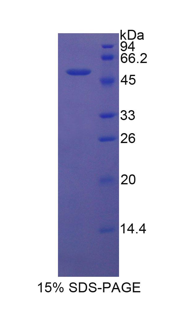 Recombinant Dickkopf Related Protein 1 (DKK1)