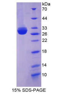 RPA744Hu01.jpg