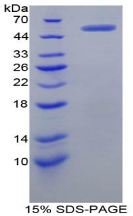 Recombinant Complement Receptor 2 (CD21)