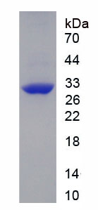 Recombinant Complement Receptor 2 (CD21)