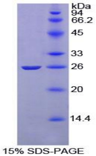 Recombinant Complement Receptor 2 (CD21)