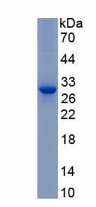 Recombinant Cluster Of Differentiation 38 (CD38)