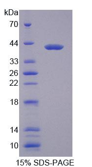 Recombinant Myosin Heavy Chain 1 (MYH1)