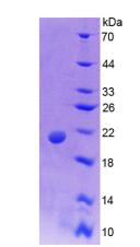 Recombinant Mucin 5 Subtype AC (MUC5AC)