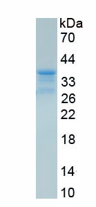 Recombinant Epidermal Growth Factor Receptor (EGFR)