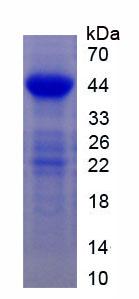 Recombinant Epidermal Growth Factor Receptor (EGFR)