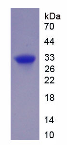 Recombinant Forkhead Box Protein P1 (FOXP1)