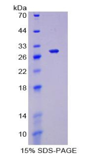 Recombinant Forkhead Box Protein P1 (FOXP1)