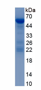 Recombinant Podocalyxin (PODXL)