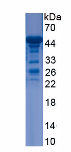 Recombinant Podocalyxin (PODXL)