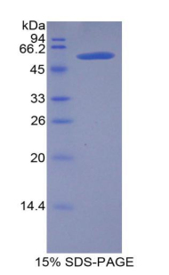 Recombinant Lipase, Hepatic (LIPC)