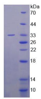 Recombinant Chemokine C-X-C-Motif Ligand 16 (CXCL16)