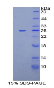 Recombinant Chemokine C-X-C-Motif Ligand 16 (CXCL16)