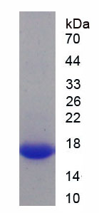 Recombinant Hexokinase 1 (HK1)