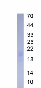 Recombinant Hexokinase 1 (HK1)