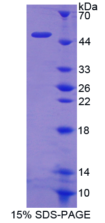 Recombinant Hexokinase 1 (HK1)