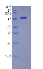 Recombinant Inducible T-Cell Co Stimulator (ICOS)