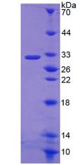 Recombinant Nicotinamide Adenine Dinucleotide Phosphate Oxidase 3 (NOX3)