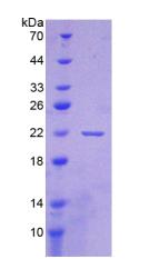 Recombinant Cluster Of Differentiation 276 (CD276)