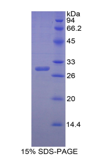 Recombinant Carbonic Anhydrase II (CA2)