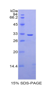 Recombinant Carbonic Anhydrase II (CA2)