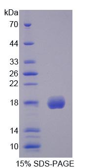 Recombinant Complement Factor P (CFP)